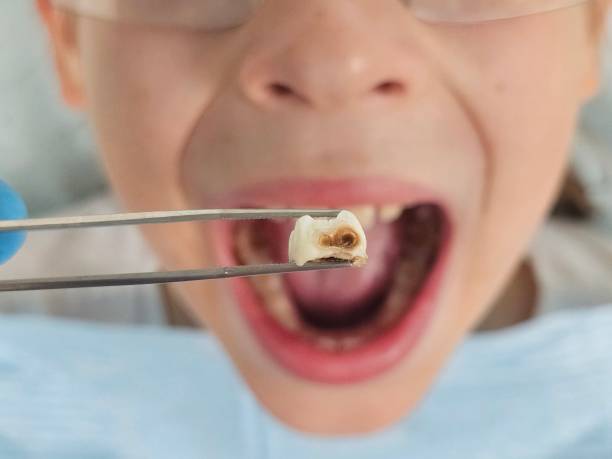 Best Emergency Treatment for Toothache in North Fork, CA